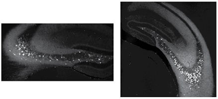 inhibitory neurons