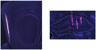 electrode traces